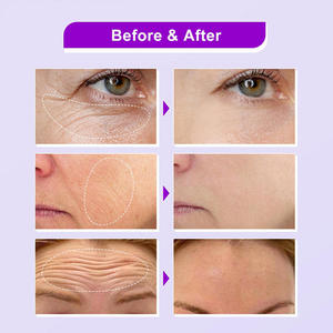Fabricante de Suero de Bakuchiol de Marca Privada, Suero Facial Orgánico Antienvejecimiento, Reduce las Líneas Finas, Antiarrugas, <span class=keywords><strong>Retinol</strong></span> 3% Bakuchiol - Product Image 5