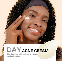 Crème Visage Hydratante Anti-acné OEM/ODM au Curcuma Biologique Jaune Foncé 150g pour la Réduction des Taches Cutanées