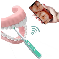 Détecteur dentaire visuel mobile intégré Wi-Fi haute définition, endoscope électrique en résine plastique, métal et acier