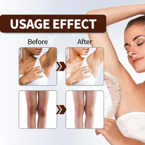 SERSANLOVE para eliminar espinillas y brillo de la piel, corrector de manchas oscuras, crema facial blanqueadora, corrección en chino 20G - Product Image 4