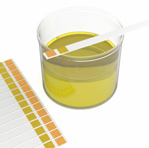 PH מטר רוק שתן ph מבחן רצועת PH4.5-9.0 מבחן רצועת קיבה - Product Image 5