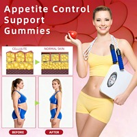 Capsules de Vinaigre de Cidre de Pomme Marque Blanche OEM ODM – Complément pour Adultes : Amincissement, Détox et Soutien Énergétique