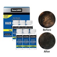 Huile capillaire nourrissante bio personnalisée pour la repousse des cheveux bouclés, formule à la biotine, traitement de croissance super rapide 5%