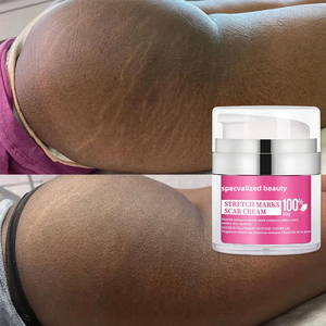Crema Corporal para el Cuidado de Estrías Piel Negra Vegana Colágeno Natural para Vientre Firme Muslos Internos y Brazos Loción para Eliminar Estrías - Product Image 3