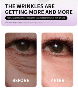 กรีนเลม ทรีทเม้นต์กระชับรอบดวงตาแบบชั่วคราว ใช้งานง่าย - Product Image 3
