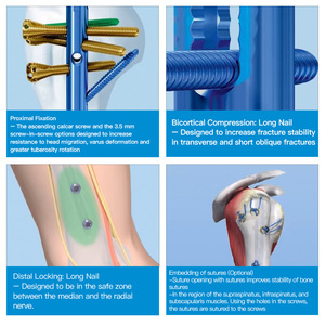Clavo Intramedular de Titanio de Grado Médico con Certificación CE e ISO para Fijación Interna de Fracturas Proximales del Húmero - Product Image 2