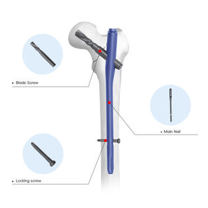 PFNA Intramedullary Nail System for Femur <strong>Fracture</strong>, Proximal <strong>Femoral</strong> Nail Antirotation for Orthopedic Trauma Surgery - Product Image 2