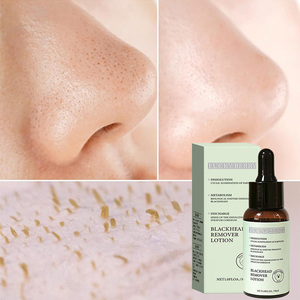 Bán buôn chống mụn trứng cá chăm sóc da Huyết thanh làm sạch sâu mũi lỗ chân lông Strips cho khuôn mặt loại bỏ mụn đầu đen thu nhỏ lỗ chân lông - Product Image 1