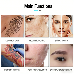 ポータブル4チップタトゥー除去機 黒ずみ除去 ピコ秒カーボンピール タトゥー除去マシン - Product Image 5