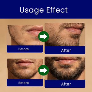 Spray de croissance de la <span class=keywords><strong>barbe</strong></span> pour hommes, croissance rapide, <span class=keywords><strong>barbe</strong></span> plus épaisse <span class=keywords><strong>et</strong></span> plus dense, spray nourrissant pour la <span class=keywords><strong>barbe</strong></span> avec biotine - Product Image 5