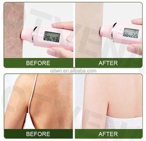 Otvena tốt nhất chống tàn nhang ngày làm trắng da Kem nuôi dưỡng sáng mặt kem thắt chặt cho da khô - Product Image 4