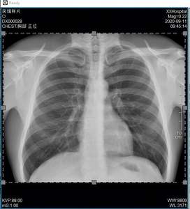 Detector de Rayos X de Panel Plano Careray Medical para <span class=keywords><strong>Mamografía</strong></span> 14 x 17, <span class=keywords><strong>Precio</strong></span> de Máquina de Rayos X - Product Image 6