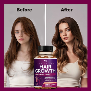 Vendita Calda Capsule Vitaminiche per Capelli 24-in-1 Avanzate OEM con Saw Palmetto, Biotina e <span class=keywords><strong>Collagene</strong></span>, <span class=keywords><strong>Integratore</strong></span> per Adulti - Product Image 3
