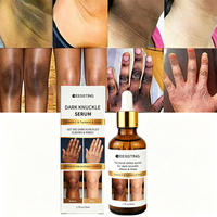Sérum Corporel Haute Qualité pour Articulations des Doigts, Éclaircissant, Hydratant, Anti-Taches Noires, Élimine la Mélanine, Blanchissant, à la Glycérine, pour Jointures Sombres
