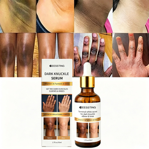 Suero de Alta Calidad para el Cuidado Corporal, Elimina las Manchas Oscuras de las Articulaciones de los Dedos, Hidrata Profundamente, Elimina la Melanina, Blanquea, con Glicerina, para los Nudillos Oscuros - Product Image 1