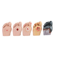 DARHMMY Modelo de Enseñanza de Maniquí de PVC para Pie Diabético, Profesional, para Ciencias Médicas, BOU/S19-1-Displays, con Niveles de Gravedad Graduados 1-5
