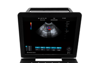 Échographe Doppler Couleur Portable P8-VET pour Vétérinaires, Écran 15 Pouces, Scanner d'Échographie Animale pour Chiens, Chats et Animaux Domestiques (Détection de Gestation)