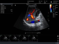 SONOIMAGE P50 High Cine Memory Full Digital Ultrasound Scanner Color Doppler Mendukung Berbagai Pemeriksaan Hewan 8 Segmen TGC