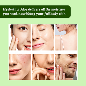 Gel Idratante all'Aloe Vera, Gel Viso e Corpo Lenitivo e Sbiancante, Riparatore per <span class=keywords><strong>Scottature</strong></span> Solari, <span class=keywords><strong>Crema</strong></span> all'Aloe Vera per la Cura della Pelle - Product Image 5