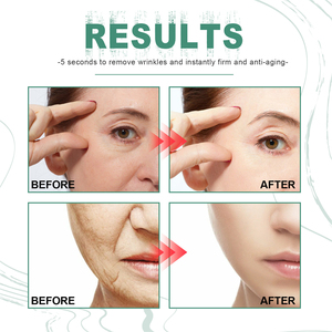 <span class=keywords><strong>Crema</strong></span> Retinol Instantánea Ouhoe para Suavizar Arrugas, <span class=keywords><strong>Crema</strong></span> Facial Antienvejecimiento, Elimina Arrugas, <span class=keywords><strong>Crema</strong></span> Hidratante, Envío Directo, <span class=keywords><strong>Crema</strong></span> para Arrugas en Segundos - Product Image 3