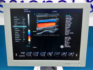 Mesin USG Medis 4D Harga Terjangkau, Mesin USG Diagnostik Doppler Warna dengan Troli, Medsinglong MSLTU04 untuk Rumah Sakit - Product Image 3