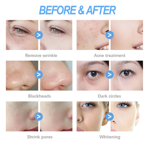 17 In 1 Stand Dermabrasion Rejuvenation Facial Machine <strong>Beauty</strong> <strong>Salon</strong> Hydra Machine - Product Image 6