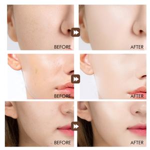 <b>New</b> Face Serum <b>Skin</b> Care Removing Dark Spots Dark Knuckles Whitening Serum for <b>Skin</b> Lightening Niacinamide Serum - Product Image 6