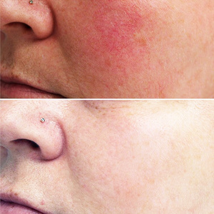 โท<span class=keywords><strong>น</strong></span>เนอร์บำรุงผิวห<span class=keywords><strong>น</strong></span>้าแตงโมเรืองแสง PHA + BHA บำรุงผิวอย่างอ่อ<span class=keywords><strong>น</strong></span>โย<span class=keywords><strong>น</strong></span>ครีมบำรุงให้ความชุ่มชื้นด้วยกรดไฮยาลูโรนิก - Product Image 5