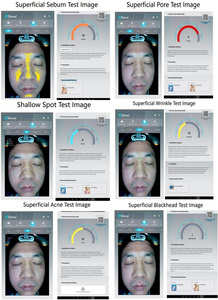 2023 Portable 3D Skin Analysis Machine Facial Uv Scan Skin Analyzer Machine Face Analyzer Machine - Product Image 6