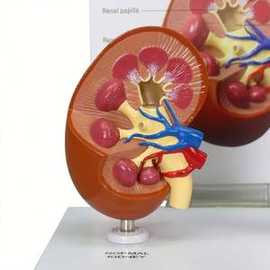 KyrenMed-Modelo de riñón animal de compañía de 2 piezas con renal normal y anatomía patológica para enseñanza veterinaria - Product Image 3