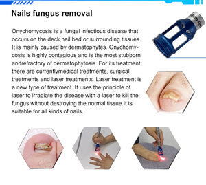 Máquina de Belleza con Láser de <span class=keywords><strong>Diodo</strong></span> de 980nm para Eliminación de Hongos en las Uñas, Arañas Vasculares, Vasos Sanguíneos, Blanqueamiento Dental con Láser de <span class=keywords><strong>Diodo</strong></span>, Curación de Heridas - Product Image 2