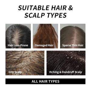 Champú Anticaída de Marca Blanca 100% Jengibre y Raíz de Ginseng, Fortalece el Cabello, Estimula el Crecimiento, Champú de Queratina para Cabello Grueso - Product Image 6