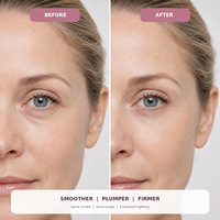 Patch Oculaire PDRN Personnalisé Bio-Collagène Peptide Hydratation Profonde Vitalité Cutanée Apaisant Masque Contour des Yeux Soutien Barrière Zones Sensibles