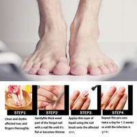Sérum Traitement Anti-Fongique Ongles 7 JOURS Réparateur, Gel Antiparasitaire Pieds, Anti-Infection Onychomycose