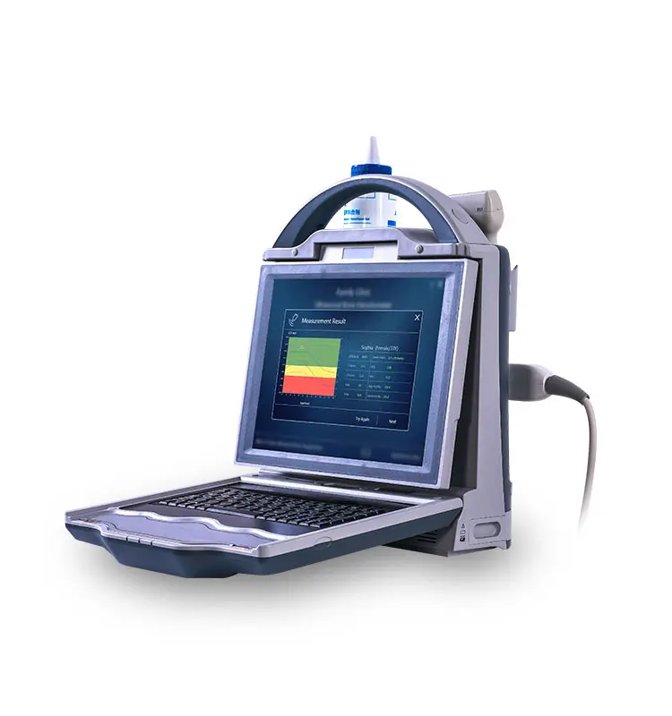 Scanner di densità ossea macchina per Test di densità ossea ad ultrasuoni per raggio e Tibia ultrasuoni densitometro osseo macchina ad ultrasuoni