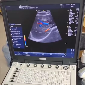 Máquina de ultrasonido LOGIQ E de suministro precio competitivo, Envío Mundial - Product Image 1