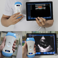 Sistema de ultrasonido de matriz en fase inalámbrico Suresult para uso médico de múltiples manijas Doppler de color