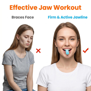 Venta al por mayor de alineadores de silicona inyectable con sabor a frutas, adhesivo dental ortodóntico para alineadores transparentes - Product Image 4