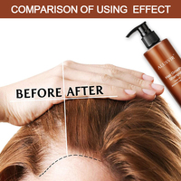 Label pribadi sampo Serum penumbuh rambut Anti rambut rontok kualitas atas organik Serum penumbuh rambut pijat kulit kepala umur rak 3 tahun