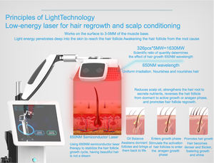 Système professionnel de détection de la croissance des cheveux 650nm avec 326 diodes, système de soin du cuir chevelu pour la repousse des cheveux, machine d'analyse cutanée - Product Image 4