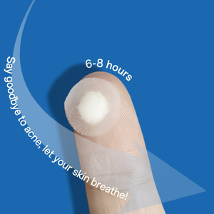 Dotdot Spot Wholesale 36 Ultra-Thin Transparent Pockmarks Acne Spot Treatment <strong>Skin</strong> Care Circle <strong>Pimple</strong> Patch Private Label - Product Image 4