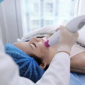 Factory Price New 5th Gen Nitrogen Beauty Expert Cooling System Face Lifting Wrinkle Removal 8-inch TFT Screen US Compatible - Product Image 6