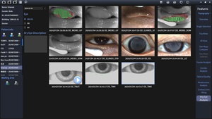 Analyseur de <span class=keywords><strong>film</strong></span> lacrymal CTG7000B, pupillomètre et scanner de forme oculaire avec fonction de pupillométrie pour un examen oculaire complet - Product Image 6