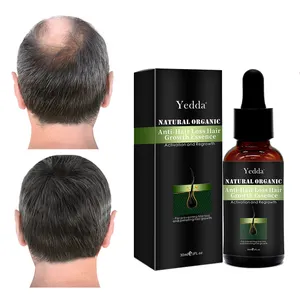 Aceite orgánico Natural para hombres y mujeres, suero de biotina esencial para la pérdida de cabello, tratamiento para el crecimiento del cabello