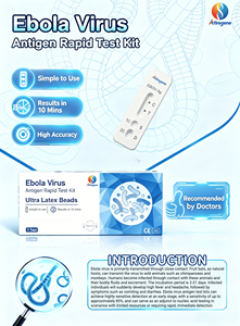 Kit <span class=keywords><strong>de</strong></span> test rapide <span class=keywords><strong>de</strong></span> l'antigène du virus Ebola pendant le <span class=keywords><strong>sommeil</strong></span>, intelligent, partage les données avec le médecin - Product Image 1