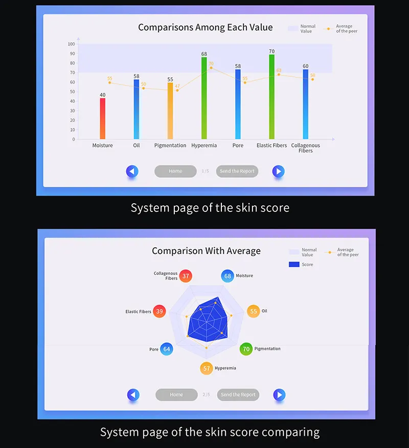 Système intelligent d'analyse de la peau 3D professionnel/rapport iSend au téléphone portable/