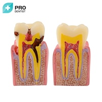 Modèle dentaire, Implants dentaires de modèle d'implant, Modèle dentaire de pont de couronne,