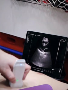 <span class=keywords><strong>Probe</strong></span> Ultrasound transrektal Portabel medis penuh Digital <span class=keywords><strong>USB</strong></span> Wifi <span class=keywords><strong>Probe</strong></span> Ultrasound Linear nirkabel - Product Image 4
