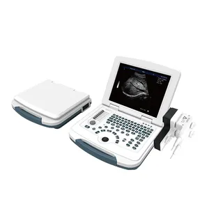 UBW580 Full Digital 2D Image 12.1inch HD LCD Medial Display Laptop Type B/W Ultrasound Machine