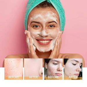 Espuma Limpiadora Facial de Cúrcuma, Limpiador Facial Blanqueador Coreano, Limpieza Profunda, Control del Acné - Product Image 6